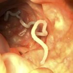 How Pets Get Tapeworms and 5 Best Dewormers
